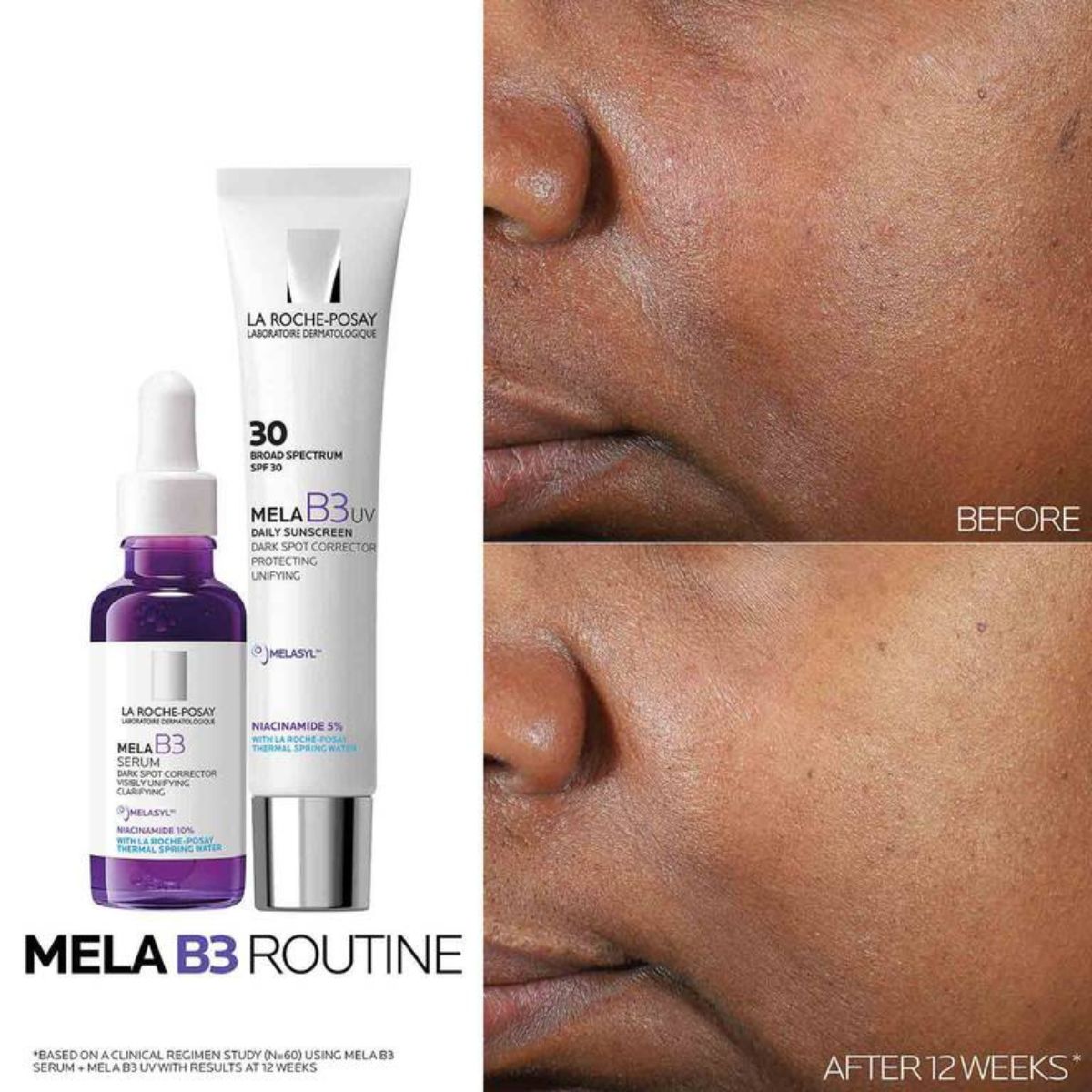 La Roche-Posay Mela B3 Serum 30ml results